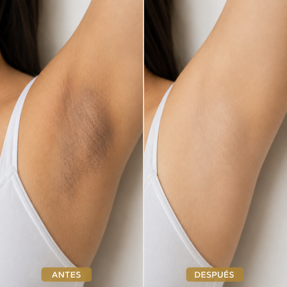 Peeling Meline Axilar - Pack de 4 Sesiones