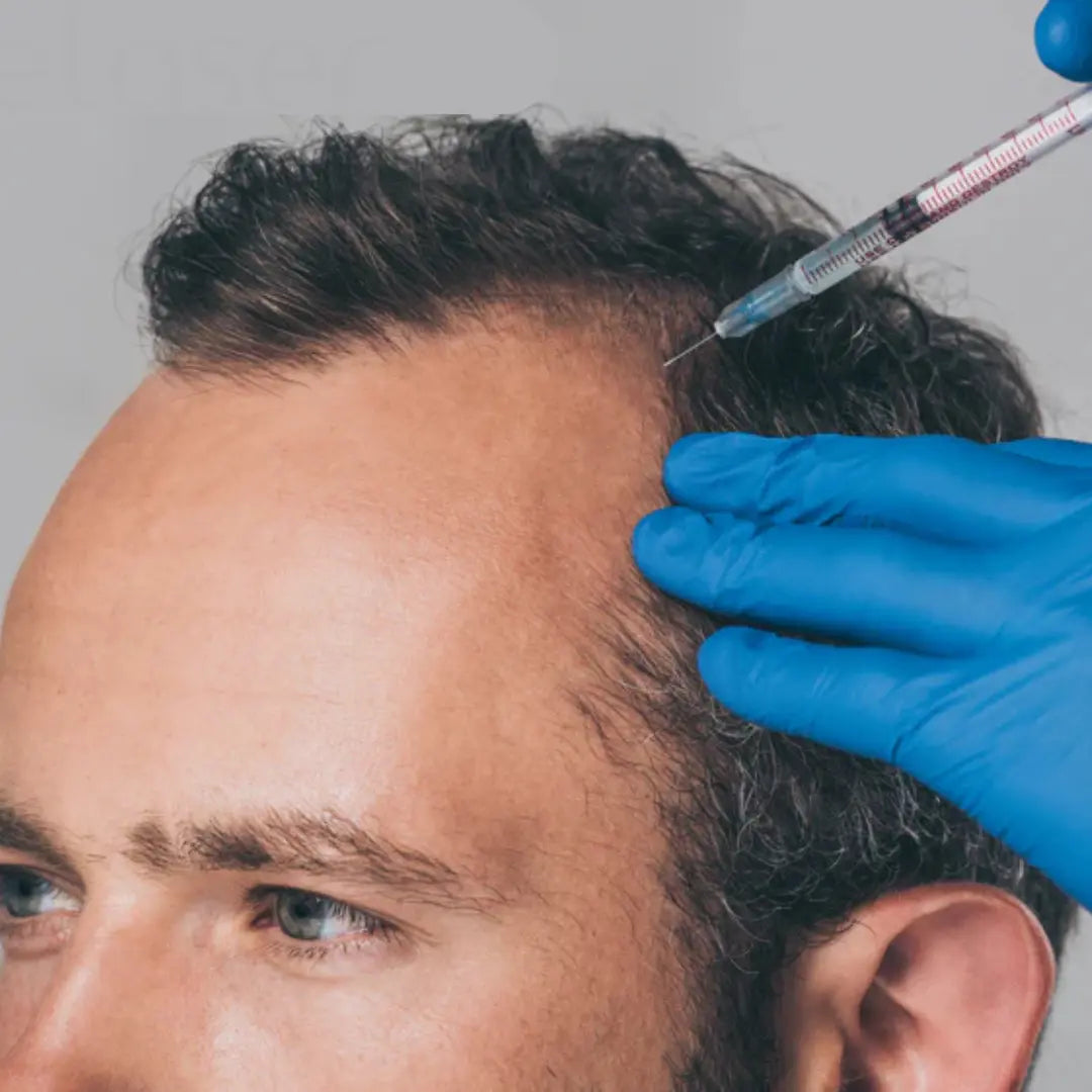 Pack Capilar Alopecia - 6 Sesiones - Clinica Altos Del Desierto