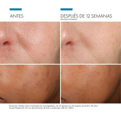 PHLORETIN CF SERUM 30 ML