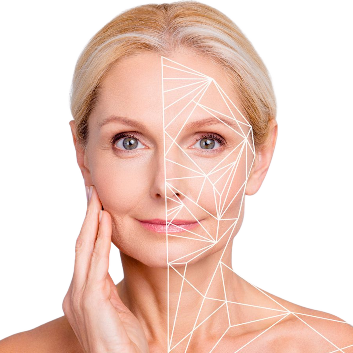 Bioestimulador Sculptra Facial
