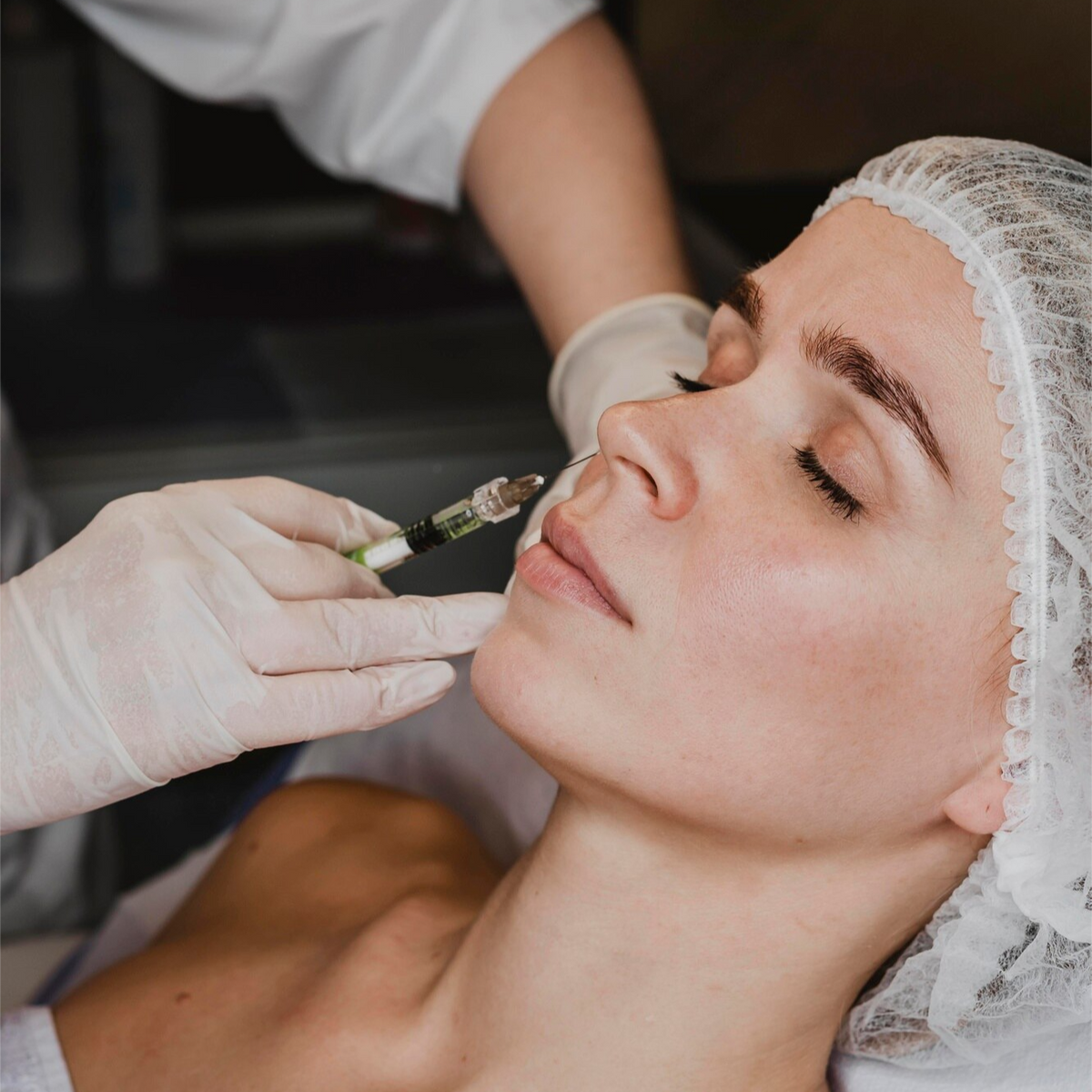 Bioestimulador Radiesse Facial